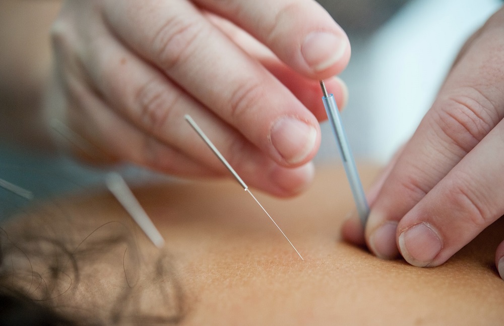 Dry Needling  Mint Hill, NC 
